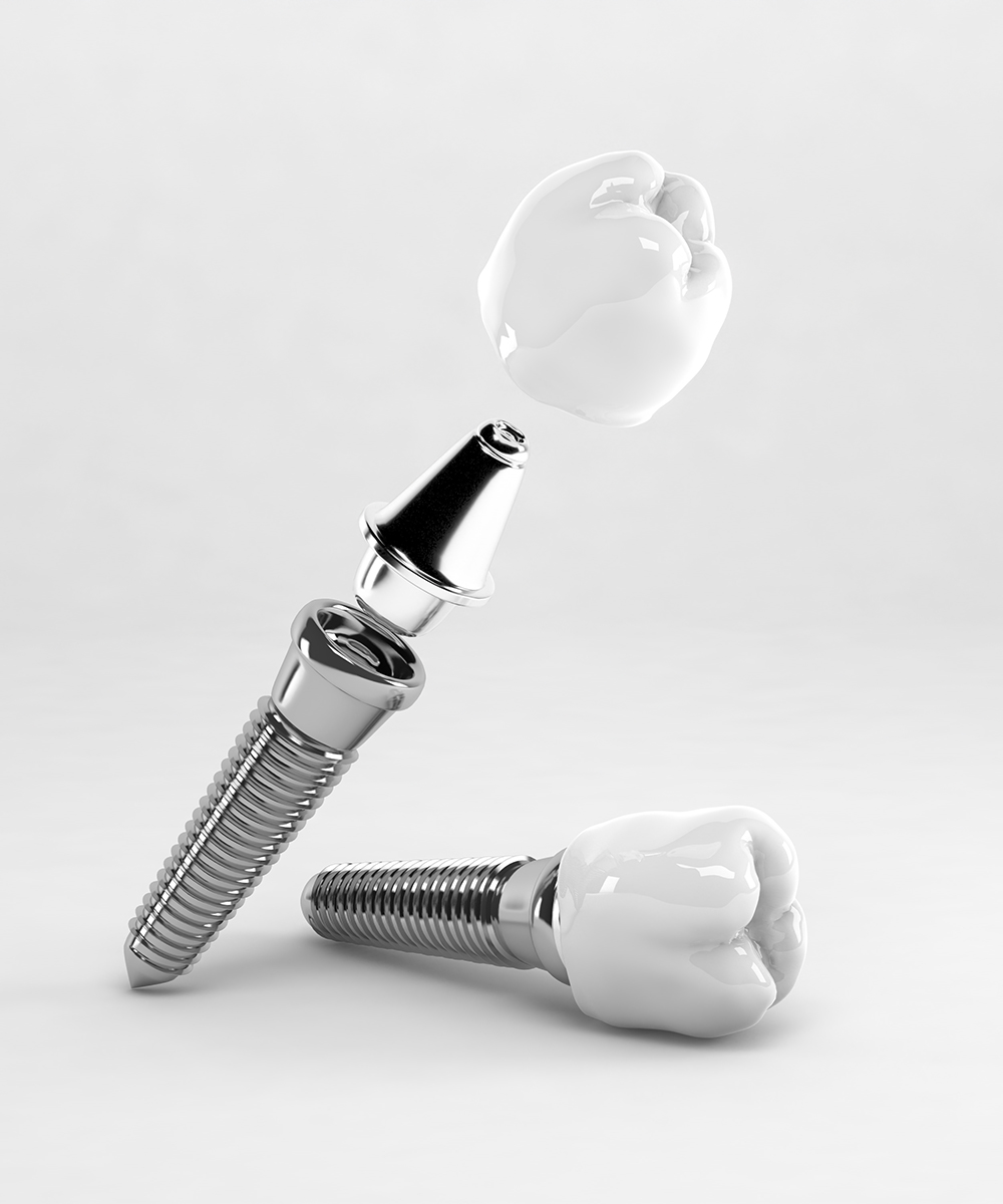 Detail of a false tooth implant fixed