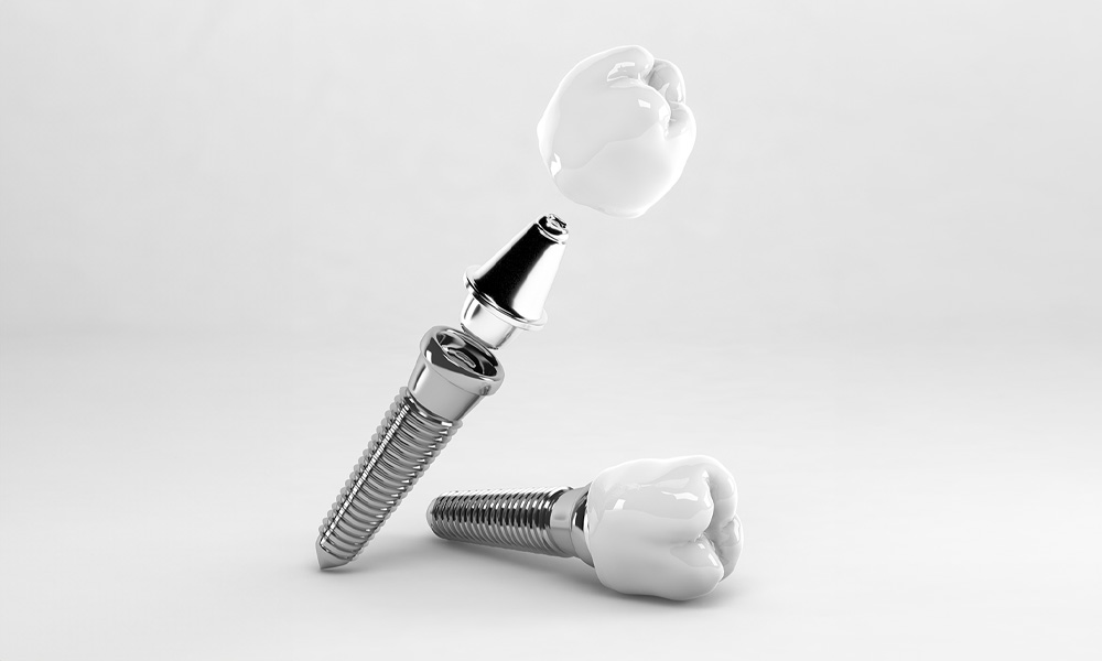 implant